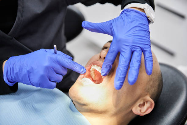 Best Emergency Root Canal Treatment in Parkston, SD