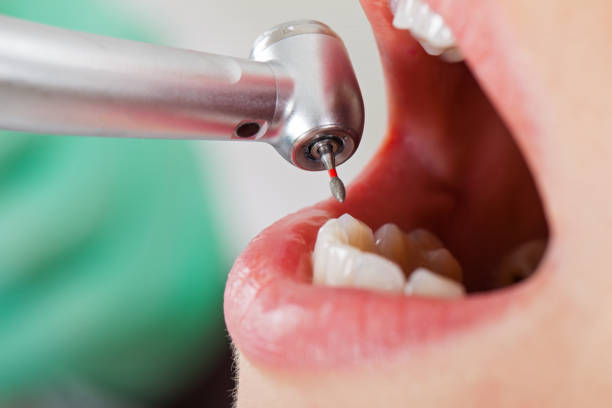 Best Weekend Emergency Dentist in Parkston, SD